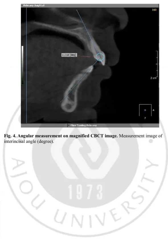Fig. 4. Angular measurement on magnified CBCT image. Measurement image of 