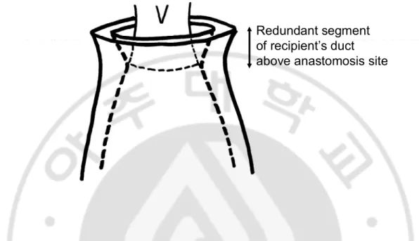 Figure 3. A pitfall in technique of graft’s duct slid into recipient’s duct to overcome size discrepancy;  If  redundant  segment  of  recipient’s  duct  were  left  over  around  anastomosis  site,  it  could  compress  graft’s  bile duct and  develop  bi
