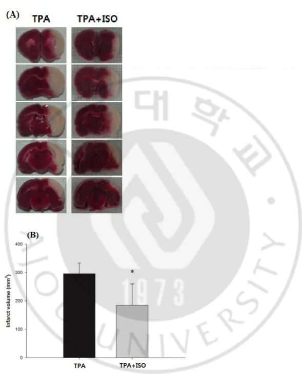 Fig. 2.TTC (2,3,5-triphenyltetrazolium chloride) stained images of brain sections from  an MCAO rats