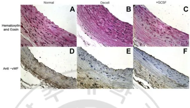 Fig.  5.  Enhanced  endothelialization  and  greater  vWF  staining  in  the  +G-CSF  specimen  compared  with  the  Decell  group(C,F,  vs  B,E)