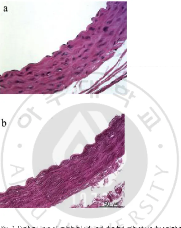 Fig.  2.  Confluent  layer  of  endothelial  cells  and  abundant  celluarity  in  the  underlying  medial layer of the normal vessel(a) and absent endothelial coverage and absence of cells  and nucleic components in the deeper medial layer in the decellul