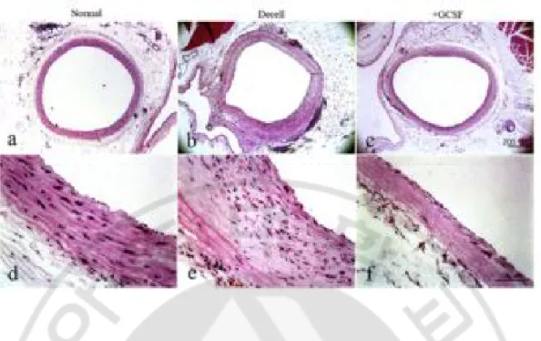 Fig.  3.  Noticeably  reduced  intimal  hyperplasia  in  the  +G-CSF  specimen  at  8  weeks  compared  with  the  Decell  specimen  whereas  medial  cellularity  is  poor  in  both  groups  compared with the normal aorta   ································