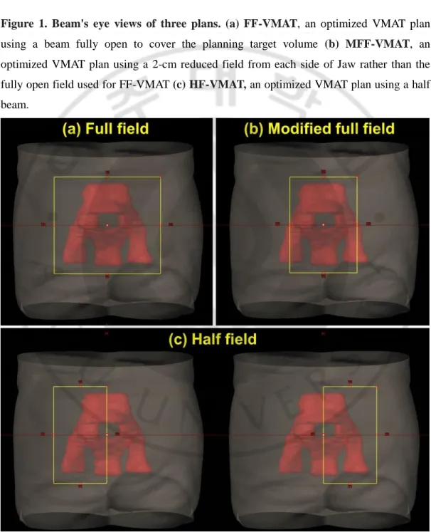 Figure  1.  Beam's  eye  views  of  three  plans.  (a)  FF-VMAT ,  an  optimized  VMAT  plan  using  a  beam  fully  open  to  cover  the  planning  target  volume   (b)  MFF-VMAT ,  an  optimized  VMAT  plan  using  a  2-cm  reduced  field  from  each  si