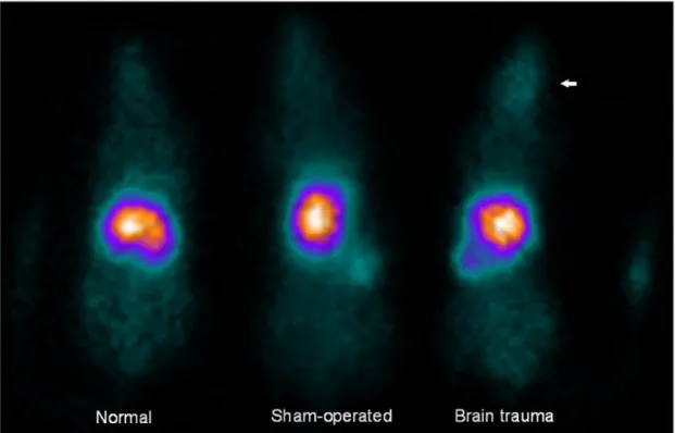 Fig. 3. In vivo distribution of  111 In-BMSCs in  acute brain trauma rats, sham-operated  control  rats  and  normal  rats  at  24  h  after  intravenous  transplantation