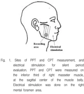 Fig.  1.  Sites  of  PPT  and  CPT  measurement,  and  electrical  stimulation  for  silent  period  evaluation