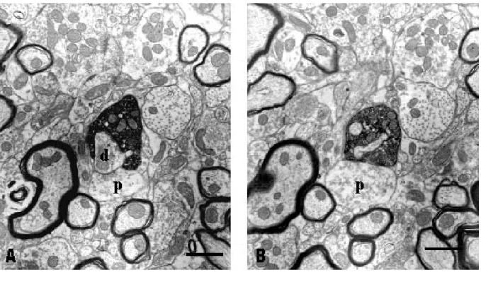 Fig.  3.  Electron  micrographs  of  a  synaptic  triad.  A  HRP-labeled  bouton  from  a  vibrissa  afferent  in  Vi  is  presynaptic  to  a  dendritic  shaft(d)  and  postsyanptic  to  ending(p)  containing  pleomorphic  vesicles  which  is  also  presyn