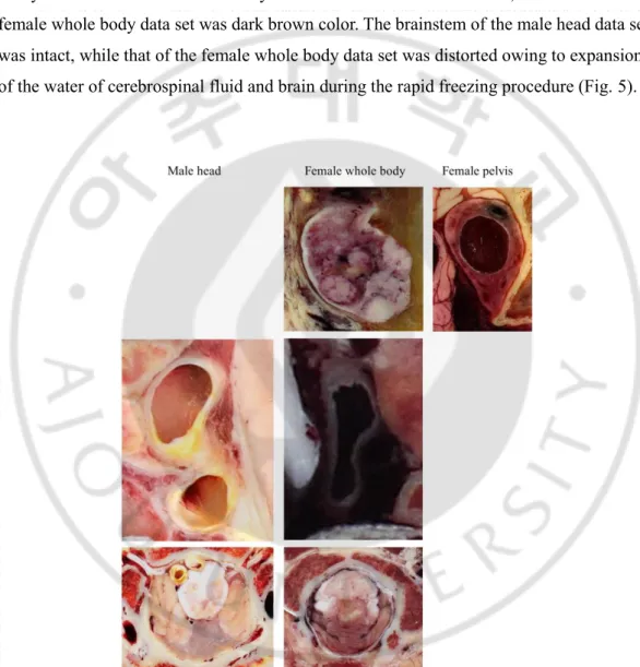 Fig. 5. Comparison of the sectioned images of female whole body, male head, and the  female pelvis