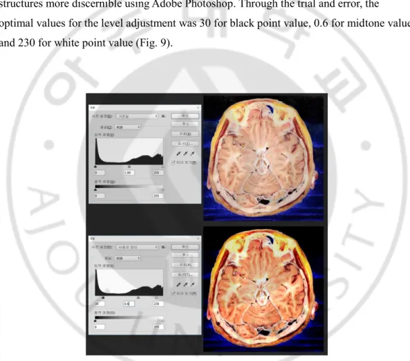 Fig. 9. Sectioned image of male head before the level adjustment (top) and after the level  adjustment (bottom) using Adobe Photoshop