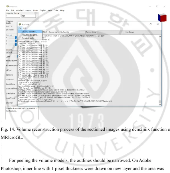 Fig. 14. Volume reconstruction process of the sectioned images using dcm2niix function of  MRIcroGL