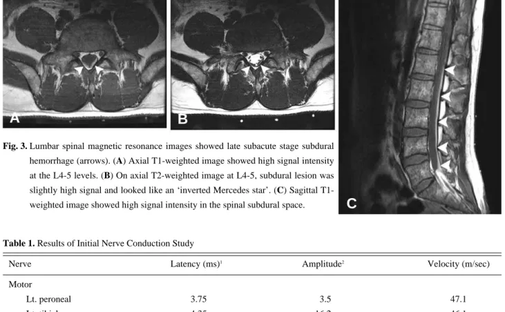 Table 1. Results of Initial Nerve Conduction Study
