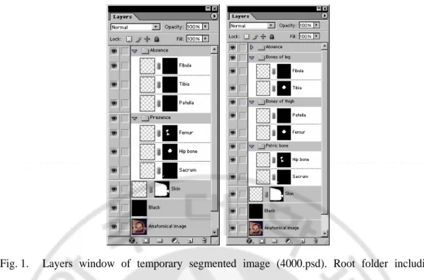 Fig. 1.  Layers  window  of  temporary  segmented  image  (4000.psd).  Root  folder  including  Anatomical  image  layer,  Black  layer,  Skin  layer,  Presence  folder  including  present  structures  layers, and Absence folder including absent structures