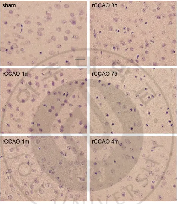 Fig. 6. No necrotic cells in rCCAO-operated mice. Sections of the right sensory cortex 