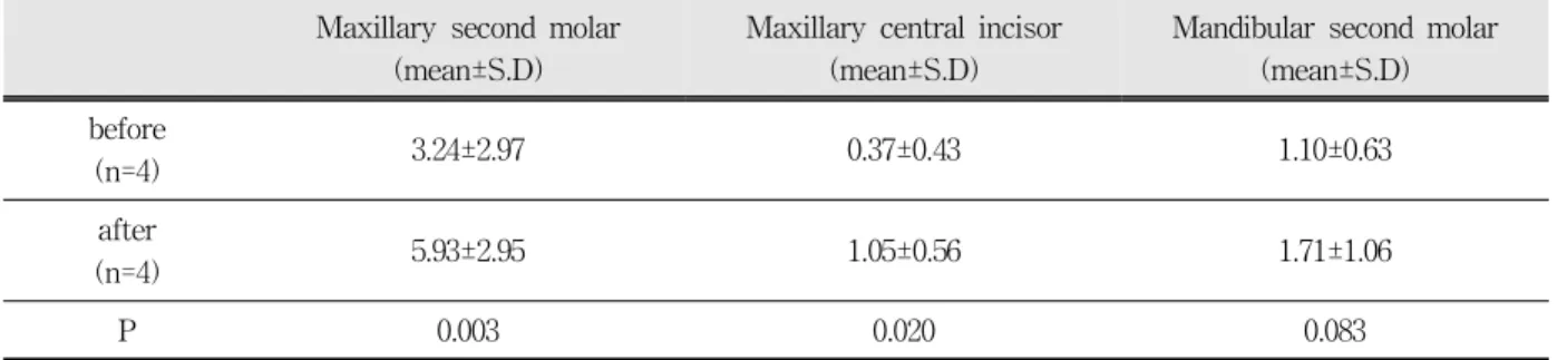 Table  2.  Statistical  comparison  of  S.  mutans  counts(×10 2   CFU/ml)