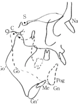 Fig. 1. Reference  points  and  planes  used  for  cephalometric  analysis