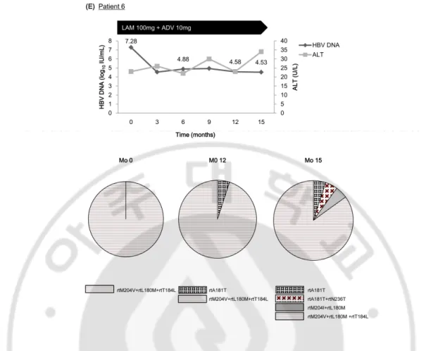 Fig. 2. Clinical course and evolution of antiviral-resistant mutations during lamivudine  (LAM) plus adefovir (ADV) therapy in 5 patients (patients 1−4, and 6) who developed  sequential resistance to LAM, ADV, and entecavir (ETV)