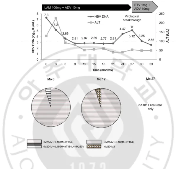 Fig. 3. Clinical course  and evolution of  antiviral-resistant  mutations  in  patient 5, who  developed  virologic  breakthrough  during  lamivudine  (LAM)  plus  adefovir  (ADV)  therapy