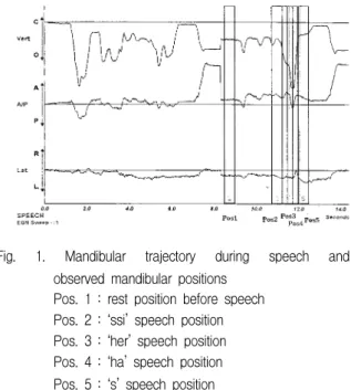 Fig.  1.  Mandibular  trajectory  during  speech  and  observed  mandibular  positions