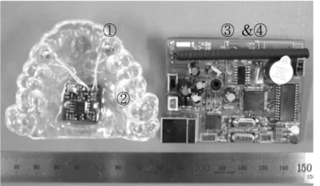 Fig.  2. Components  of  the  newly-developed  appliance  for  bruxism;  ①switch(detection  sensor),  ②central  processing  unit  (CPU), 