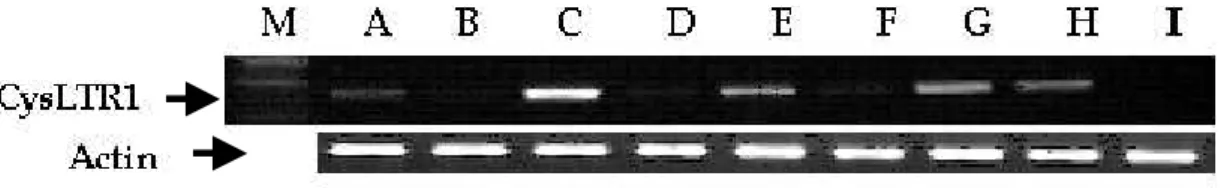 Fig.    4. Expression of CysLTR1 mRNA in various cell lines. Four micrograms 