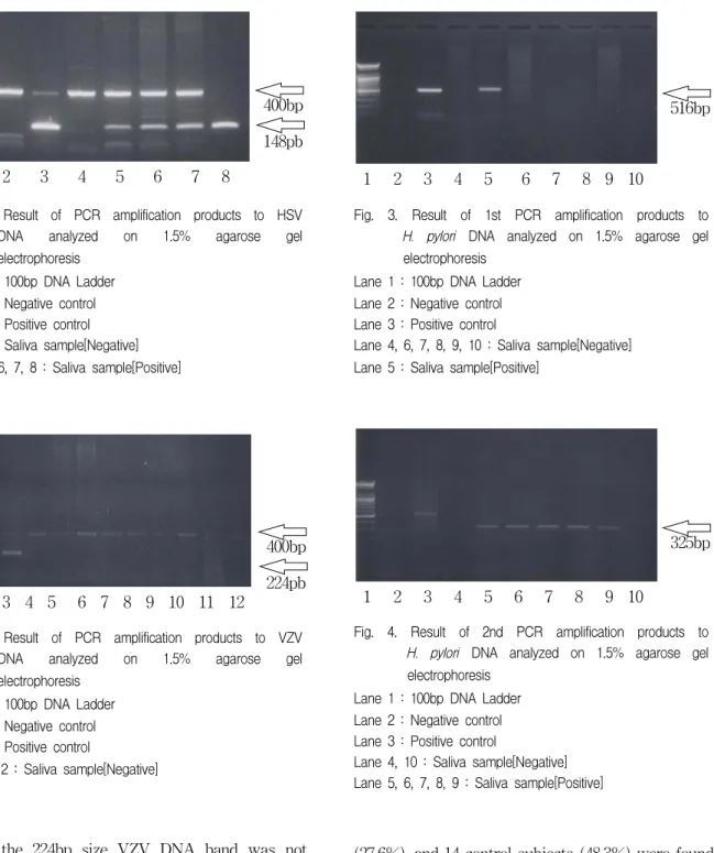 Fig.  1.  Result  of  PCR  amplification  products  to  HSV  DNA  analyzed  on  1.5%  agarose  gel  electrophoresis