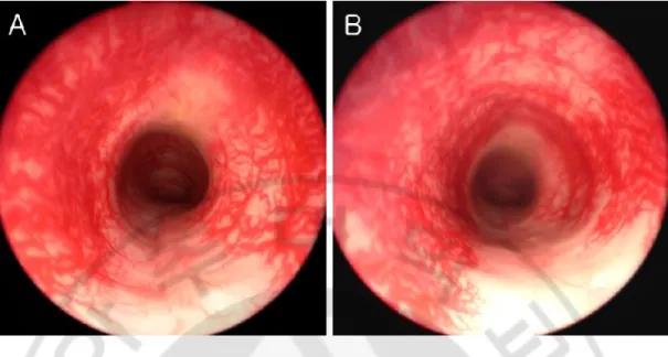 Fig.  5.Findings  of  endoscopy  of  the  rabbit  trachea.  The  implant  was  a  good  fit  on  the 