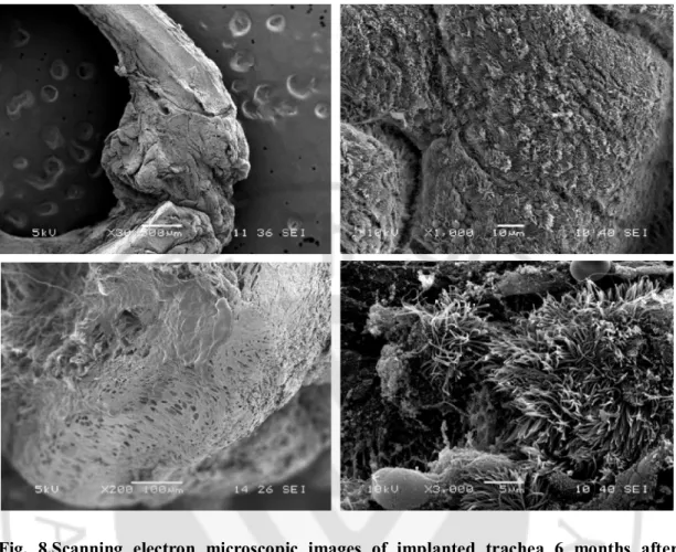 Fig.  8.Scanning  electron  microscopic  images  of  implanted  trachea  6  months  after  surgery.Gross  images  of  the  implanted  trachea  and  the  adjacent  normal  trachea  (A)