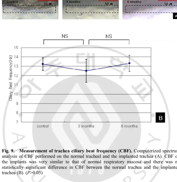 Fig. 9.  Measurement of trachea ciliary beat  frequency (CBF). Computerized spectrum 
