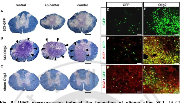 Fig.  8.  Olig2  overexpression  induced  the  formation  of  glioma  after  SCI.  (A-C)  Representative images of eriochrome / Cresyl Violet stained sections at the 1.8 mm rostral to  the  epicenter,  epicenter, and  1.8  mm  caudal  to  the  epicenter