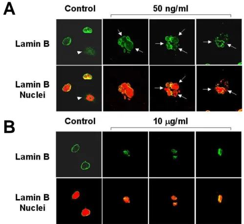 Fig. 10.      Patterns of nuclear lamin B distribution in LD doxorubicin-induced  cell  death  through  mitotic  catatrophe  and  HD  doxorubicin-induced  apoptosis