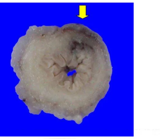 Fig. 7. Gross specimen of bladder from dog with embolization. The specimen shows focal 