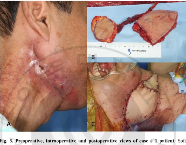 Fig.  3.  Preoperative,  intraoperative  and  postoperative  views  of  case  #  1  patient