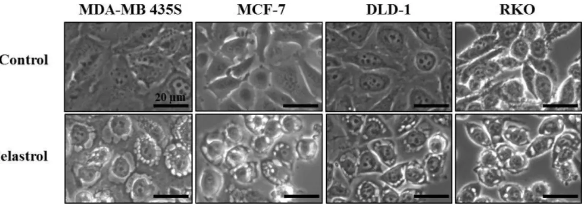 Fig.  4.  Morphological  changes  in  celastrol-treated  cancer  cells.  MDA-MB  435S, 