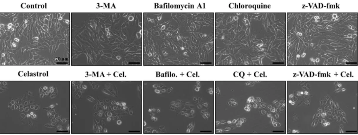 Fig.  6.  Effects  of  3-MA,  bafilomycin,  or  chloroquine  on  celastrol-induced  vacuolation