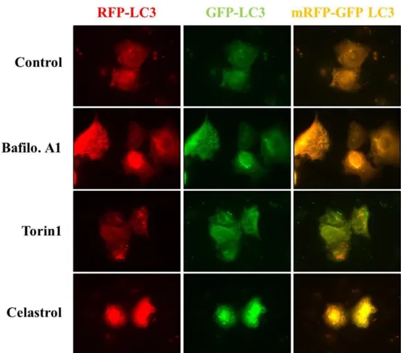 Fig. 9. Expression of mRFP-GFP-LC3 in breast cancer cells treated with celastrol. 