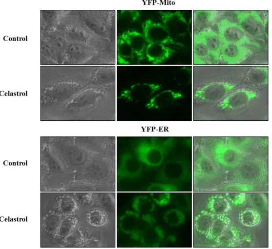 Fig.  10.  Swelling  of  mitochondria  and  the  ER  is  induced  by  celastrol  treatment