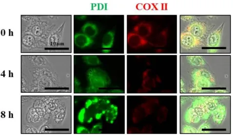 Fig.  12.  Celastrol  induces  the  expression  levels  of  PDI  in  MDA-MB  435S  cells