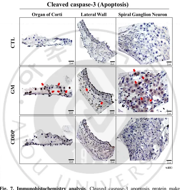 Fig.  7.  Immunohistochemistry  analysis.  Cleaved  caspase-3  apoptosis  protein  maker  staining was much more highly expressed in the organ of Corti, spiral ganglions and lateral  ligaments  in  GM-induced  ototoxicity  (red  arrow)  compared  with  Con