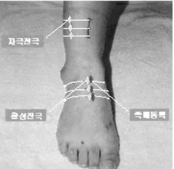Table 2. Locations of Stimulating and Active Electrode  