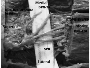 Fig. 1. Peroneal nerve after dissection of the fibular cannel SPN: superficial peroneal nerve, DPN: deep peroneal nerve, TA: tibialis anterior, EDB: extensor digitorum brevis, EDL: extensor digitorum longus, EHL: extensor hallucis longus