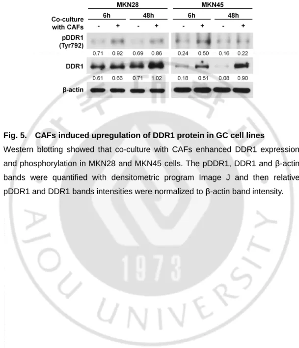Fig. 5.    CAFs induced upregulation of DDR1 protein in GC cell lines 