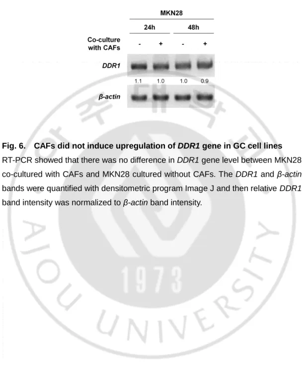 Fig. 6.    CAFs did not induce upregulation of DDR1 gene in GC cell lines 