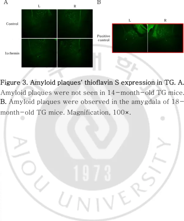 Figure 3. Amyloid plaques ’ thioflavin S expression in TG. A.  Amyloid plaques were not seen in 14-month-old TG mice