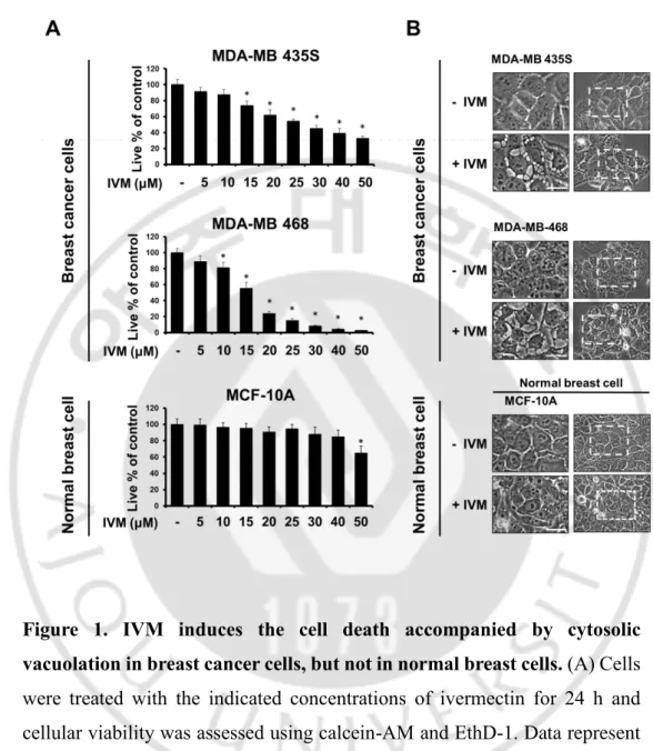 Figure  1.  IVM  induces  the  cell  death  accompanied  by  cytosolic  vacuolation in breast cancer cells, but not in normal breast cells
