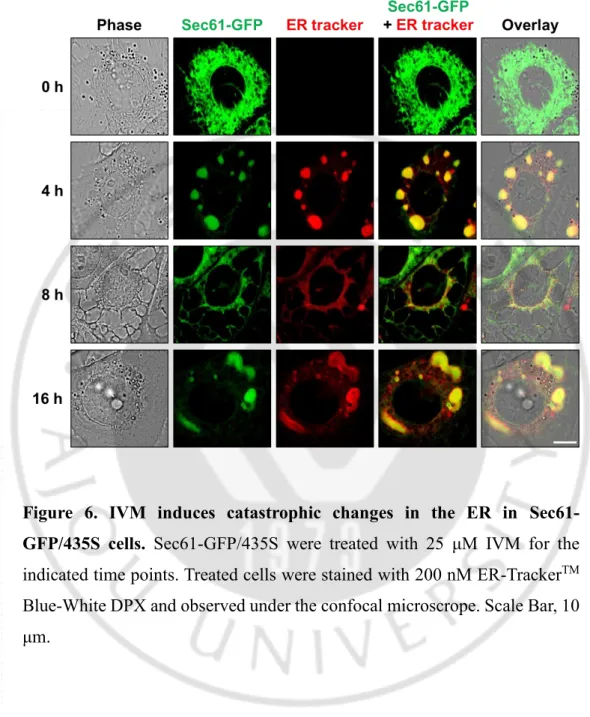 Figure  6.  IVM  induces  catastrophic  changes  in  the  ER  in  Sec61-  GFP/435S  cells