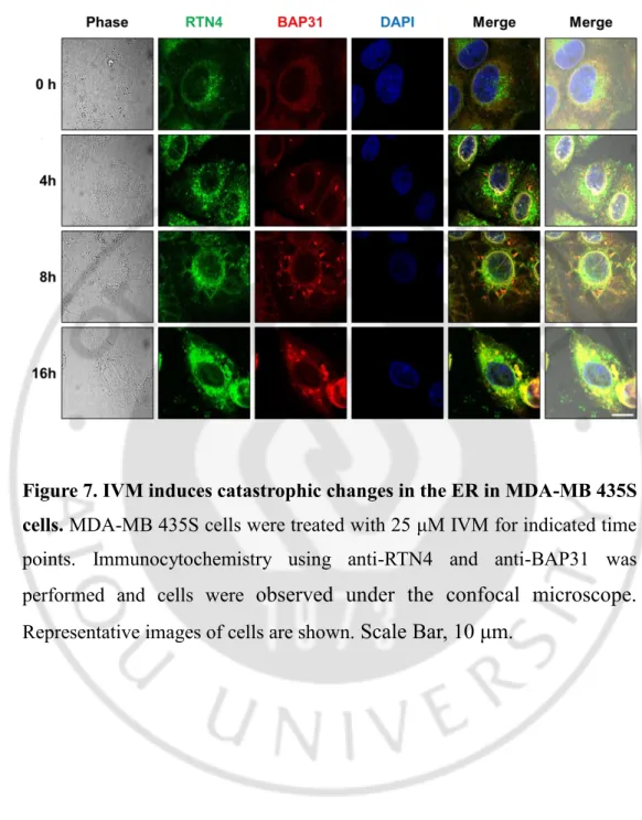 Figure 7. IVM induces catastrophic changes in the ER in MDA-MB 435S  cells. MDA-MB 435S cells were treated with 25 μM IVM for indicated time 