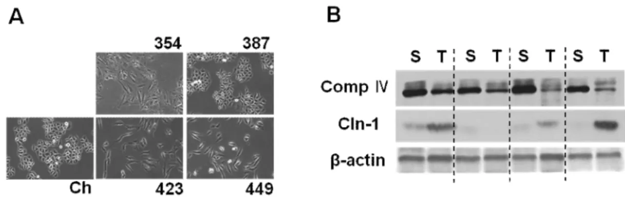Fig. 2. Cln-1 is associated with mitochondrial dysfunction of hepatoma cell. A) Cellular  morphology  of  Chang  cell  clone  (Ch-L)  and  four  different  SNU  hepatoma  cell  lines  (SNU354,  SNU387,  SNU423,  and  SNU449)