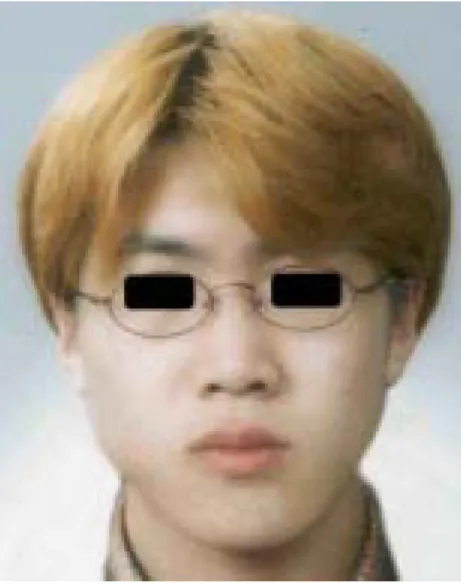 Fig.  1.  Frontal  photograph  of  thepatient