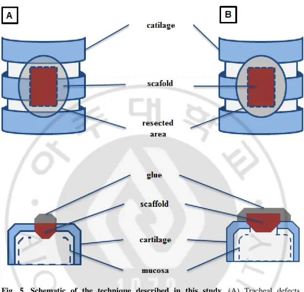 Fig.  5.  Schematic  of  the  technique  described  in  this  study.  (A)  Tracheal  defects, 
