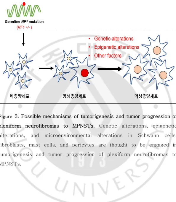 Figure   3.  Possible  mechanisms  of  tumorigenesis  and  tumor  progression  of  plexiform  neurofibromas  to  MPNSTs