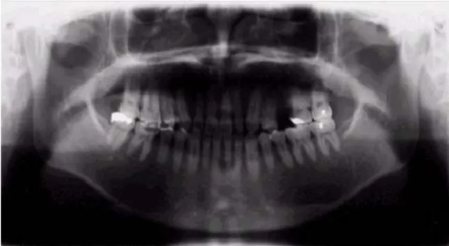 Fig.  1.  Panoramic  radiograph  of  the  head.